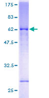 GRIK2 / GLUR6 Protein - 12.5% SDS-PAGE of human GRIK2 stained with Coomassie Blue