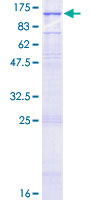 GRIK3 / GLUR7 Protein - 12.5% SDS-PAGE of human GRIK3 stained with Coomassie Blue