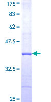 GRIK3 / GLUR7 Protein - 12.5% SDS-PAGE Stained with Coomassie Blue.