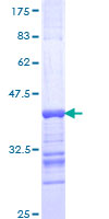 GRIK4 / KA1 Protein - 12.5% SDS-PAGE Stained with Coomassie Blue.