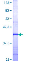 GRIN1 / NMDAR1 Protein - 12.5% SDS-PAGE Stained with Coomassie Blue.