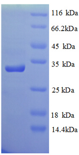GRIN2A / NMDAR2A / NR2A Protein