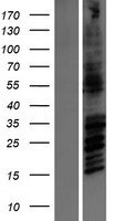 GRIN2B / NMDAR2B / NR2B Protein - Western validation with an anti-DDK antibody * L: Control HEK293 lysate R: Over-expression lysate