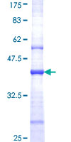 GRIN2B / NMDAR2B / NR2B Protein - 12.5% SDS-PAGE Stained with Coomassie Blue.