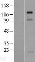 GRIP1 Protein - Western validation with an anti-DDK antibody * L: Control HEK293 lysate R: Over-expression lysate