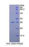 GRIP1 Protein - Recombinant Glutamate Receptor Interacting Protein 1 By SDS-PAGE