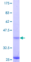 GRIPAP1 / GRASP1 Protein - 12.5% SDS-PAGE Stained with Coomassie Blue.