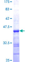 GRK4 Protein - 12.5% SDS-PAGE Stained with Coomassie Blue.