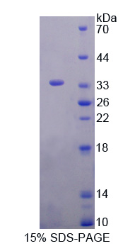 GRK4 Protein - Recombinant  G Protein Coupled Receptor Kinase 4 By SDS-PAGE
