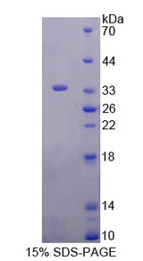 GRK4 Protein - Recombinant  G Protein Coupled Receptor Kinase 4 By SDS-PAGE
