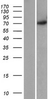 GRK5 Protein - Western validation with an anti-DDK antibody * L: Control HEK293 lysate R: Over-expression lysate