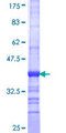 GRK5 Protein - 12.5% SDS-PAGE Stained with Coomassie Blue.