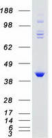 GRK5 Protein - Purified recombinant protein GRK5 was analyzed by SDS-PAGE gel and Coomassie Blue Staining
