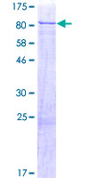 GRK6 Protein - 12.5% SDS-PAGE of human GRK6 stained with Coomassie Blue