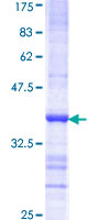 GRK6 Protein - 12.5% SDS-PAGE Stained with Coomassie Blue.