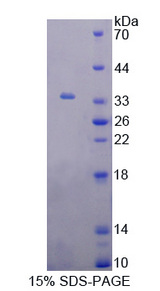 GRK6 Protein - Recombinant  G Protein Coupled Receptor Kinase 6 By SDS-PAGE