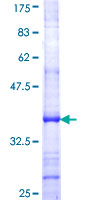 GRM2 / MGLUR2 Protein - 12.5% SDS-PAGE Stained with Coomassie Blue.