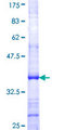 GRM2 / MGLUR2 Protein - 12.5% SDS-PAGE Stained with Coomassie Blue.