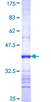 GRM3 / MGLUR3 Protein - 12.5% SDS-PAGE Stained with Coomassie Blue.