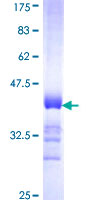 GRM6 / MGLUR6 Protein - 12.5% SDS-PAGE Stained with Coomassie Blue.