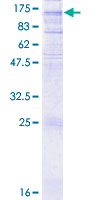 GRM7 / MGLUR7 Protein - 12.5% SDS-PAGE of human GRM7 stained with Coomassie Blue
