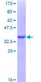 GRN / Granulin Protein - 12.5% SDS-PAGE Stained with Coomassie Blue.