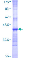 Growth Hormone Receptor / GHR Protein - 12.5% SDS-PAGE Stained with Coomassie Blue.