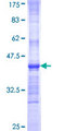 Growth Hormone Receptor / GHR Protein - 12.5% SDS-PAGE Stained with Coomassie Blue.