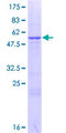GRPEL2 Protein - 12.5% SDS-PAGE of human GRPEL2 stained with Coomassie Blue