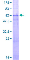 GRPR Protein - 12.5% SDS-PAGE of human GRPR stained with Coomassie Blue