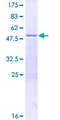 GS28 / GOSR1 / p28 Protein - 12.5% SDS-PAGE of human GOSR1 stained with Coomassie Blue