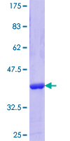 GS28 / GOSR1 / p28 Protein - 12.5% SDS-PAGE Stained with Coomassie Blue.
