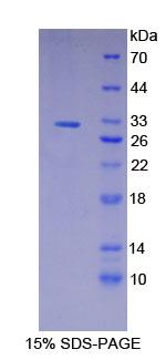 GSAP / PION Protein - Recombinant Gamma-Secretase Activating Protein By SDS-PAGE