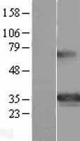 GSC / Goosecoid Protein - Western validation with an anti-DDK antibody * L: Control HEK293 lysate R: Over-expression lysate