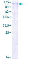 GSG2 / HASPIN Protein - 12.5% SDS-PAGE of human GSG2 stained with Coomassie Blue
