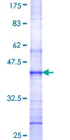 GSG2 / HASPIN Protein - 12.5% SDS-PAGE Stained with Coomassie Blue.