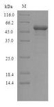 GSK3B / GSK3 Beta Protein - (Tris-Glycine gel) Discontinuous SDS-PAGE (reduced) with 5% enrichment gel and 15% separation gel.