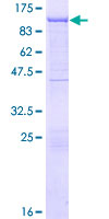 GSN / Gelsolin Protein - 12.5% SDS-PAGE of human GSN stained with Coomassie Blue