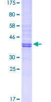 GSN / Gelsolin Protein - 12.5% SDS-PAGE Stained with Coomassie Blue.