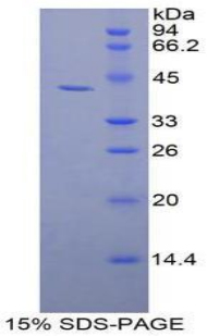 GSN / Gelsolin Protein - Recombinant Gelsolin By SDS-PAGE
