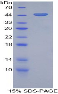Gelsolin Protein Recombinant His-GST aa 