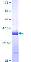 GSR / Glutathione Reductase Protein - 12.5% SDS-PAGE Stained with Coomassie Blue.