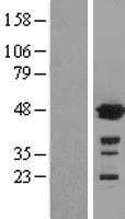 GSS / Glutathione Synthetase Protein - Western validation with an anti-DDK antibody * L: Control HEK293 lysate R: Over-expression lysate