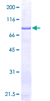 GSS / Glutathione Synthetase Protein - 12.5% SDS-PAGE of human GSS stained with Coomassie Blue
