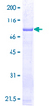 GSS / Glutathione Synthetase Protein - 12.5% SDS-PAGE of human GSS stained with Coomassie Blue