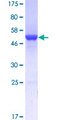 GSTA1 Protein - 12.5% SDS-PAGE of human GSTA1 stained with Coomassie Blue