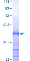 GSTA2 Protein - 12.5% SDS-PAGE Stained with Coomassie Blue.