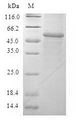GSTA2 Protein - (Tris-Glycine gel) Discontinuous SDS-PAGE (reduced) with 5% enrichment gel and 15% separation gel.