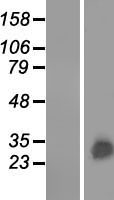 GSTA3 Protein - Western validation with an anti-DDK antibody * L: Control HEK293 lysate R: Over-expression lysate