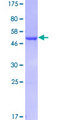 GSTA3 Protein - 12.5% SDS-PAGE of human GSTA3 stained with Coomassie Blue